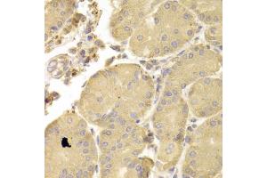 Immunohistochemistry of paraffin-embedded human stomach using ATG7 antibody (ABIN6292614) at dilution of 1:100 (40x lens). (ATG7 抗体)