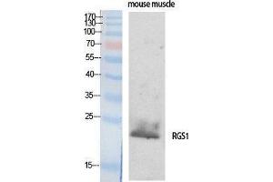 Western Blotting (WB) image for anti-Regulator of G-Protein Signaling 1 (RGS1) (Internal Region) antibody (ABIN3177204) (RGS1 抗体  (Internal Region))