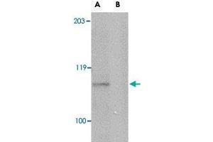 Western blot analysis of GP6 in mouse brain lysate with GP6 polyclonal antibody  at 1 ug/mL in either the absence or (B) the presence of blocking peptide. (GP6 抗体  (Internal Region))