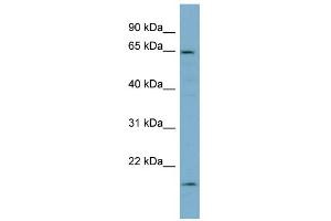 WB Suggested Anti-PLS3 Antibody Titration: 0.