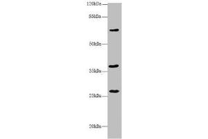 Western blot All lanes: GNS antibody at 3. (GNS 抗体  (AA 293-552))