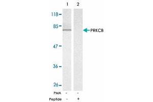 Western blot analysis of exreacts from K-562 untreated or treated with PMA (1 ng/mL, 10 min) using PRKCB polyclonal antibody . (PKC beta 抗体)