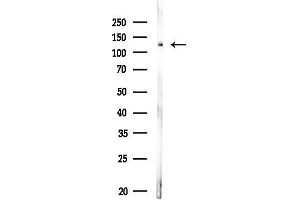 Western blot analysis of lysates from MDA-MB-231 cells, using p130 Cas Antibody at 1/1000 dilution.