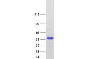Western Blotting (WB) image for phospholipid Scramblase 3 (PLSCR3) protein (Myc-DYKDDDDK Tag) (ABIN2729195)
