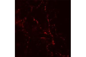 Immunocytochemistry (ICC) image for anti-Synaptotagmin II (SYT2) (AA 1-11), (Lumenal Region) antibody (ABIN1742203)
