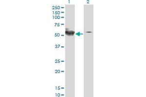 Western Blot analysis of STK38 expression in transfected 293T cell line by STK38 monoclonal antibody (M01A), clone 2G8-1F3.