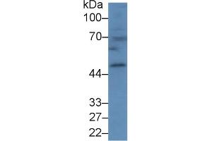 Detection of CPB1 in Mouse Spleen lysate using Polyclonal Antibody to Carboxypeptidase B1, Tissue (CPB1) (CPB1 抗体  (AA 109-415))
