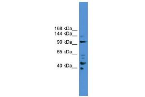 WB Suggested Anti-PIBF1 Antibody Titration: 0. (PIBF1 抗体  (C-Term))