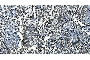 IHC analysis of PCBP2/hnRNP E2 using anti-PCBP2/hnRNP E2 antibody (ABIN7600449). (PCBP2 抗体  (AA 197-276))