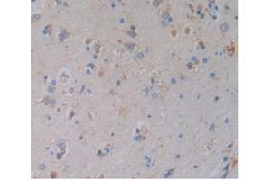Detection of HO1 in Human Brain Tissue using Monoclonal Antibody to Heme Oxygenase 1 (HO1) (HMOX1 抗体  (AA 61-172))