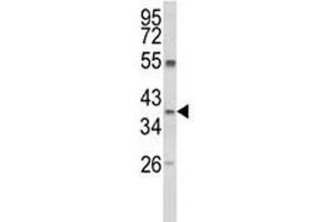 Western blot analysis of ARG1 antibody and MDA-MB231 lysate (Liver Arginase 抗体  (AA 293-322))
