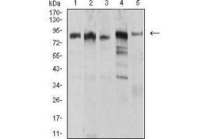Western blot analysis using UHRF1 mouse mAb against MCF-7 (1), HCT116 (2), HL-60 (3), Hela (4), and HEK293 (5) cell lysate. (UHRF1 抗体  (AA 616-755))