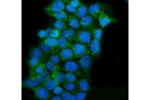 IF analysis of CLPP using anti-CLPP antibody (ABIN5693176).