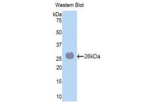 Western Blotting (WB) image for anti-Laminin, alpha 4 (LAMa4) (AA 745-940) antibody (ABIN1859600) (LAMa4 抗体  (AA 745-940))