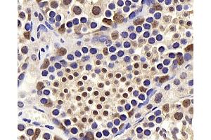 Immunohistochemistry analysis of paraffin-embedded mouse testis using BRAF Polyclonal Antibody at dilution of 1:400. (BRAF 抗体)