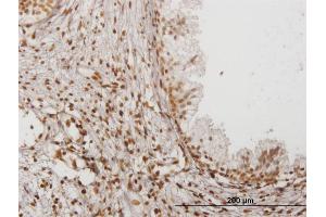 Immunoperoxidase of monoclonal antibody to IFI16 on formalin-fixed paraffin-embedded human prostate. (IFI16 抗体  (AA 630-729))