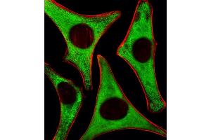 Fluorescent image of Hela cells stained with RPS6 Antibody (N-term) . (RPS6 抗体)