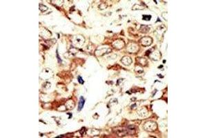 Image no. 2 for anti-Insulin Receptor-Related Receptor (INSRR) (C-Term) antibody (ABIN359889) (INSRR 抗体  (C-Term))