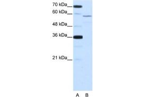 Western Blotting (WB) image for anti-Neuro-Oncological Ventral Antigen 2 (NOVA2) antibody (ABIN2462125) (NOVA2 抗体)