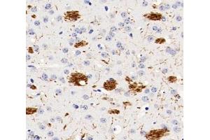 Immunohistochemistry analysis of paraffin-embedded rat brain using,PGS1 (ABIN7075039) at dilution of 1: 600 (PGS1 抗体)