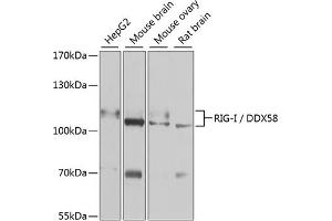 Western blot analysis of extracts of various cell lines, using Rig-I/DDX58 antibody (ABIN6130263, ABIN6139513, ABIN6139515 and ABIN6217394) at 1:1000 dilution. (DDX58 抗体  (AA 726-925))