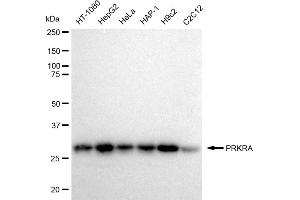 anti-Protein Kinase, Interferon-Inducible Double Stranded RNA Dependent Activator (PRKRA) antibody