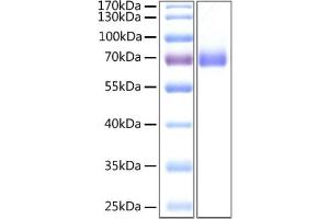 SARS-CoV-2 Spike S2 Protein (ECD) (His tag)