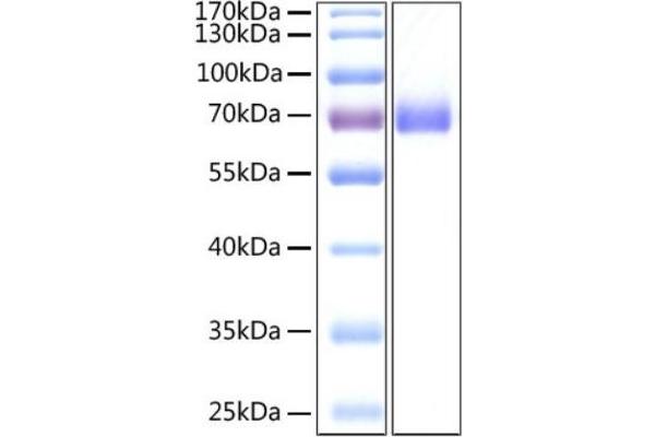 SARS-CoV-2 Spike S2 Protein (ECD) (His tag)