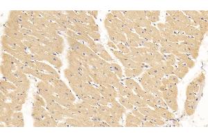 Detection of SLN in Human Cardiac Muscle Tissue using Polyclonal Antibody to Sarcolipin (SLN) (SLN 抗体  (AA 1-31))
