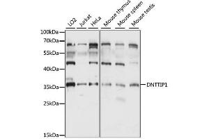 Western blot analysis of extracts of various cell lines, using DNTTIP1 antibody (ABIN6290313) at 1:1000 dilution. (DNTTIP1 抗体)