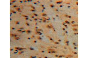 IHC-P analysis of brain tissue, with DAB staining. (PKC gamma 抗体  (AA 351-614))
