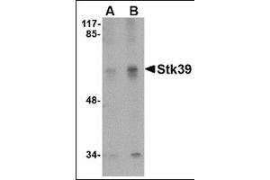 Western blot analysis of Stk39 in SK-N-SH cell lysate with this product at (A) 1 and (B) 2 μg/ml. (STK39 抗体  (C-Term))