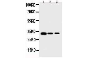 Anti-human Survivin antibody, Western blotting Lane 1: Recombinant Human Survivin Protein 10ng Lane 2: Recombinant Human Survivin Protein 5ng Lane 3: Recombinant Human Survivin Protein 2
