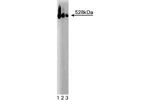 Western blot analysis of BRUCE on a SW-13 cell lysate (Human adrenal gland carcinoma, ATCC CCL-105).