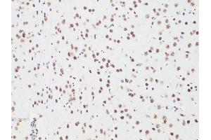 Immunohistochemistry of paraffin-embedded Rat brain using Bcl9 antibody (ABIN6129972, ABIN6137514, ABIN6137515 and ABIN6222543) at dilution of 1:100 (20x lens). (BCL9 抗体)