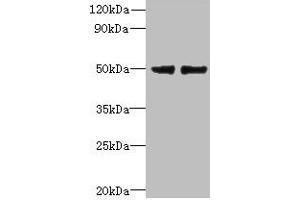 Western blot All lanes: FAM118B antibody at 12 μg/mL Lane 1: Jurkat whole cell lysate Lane 2: U251 whole cell lysate Secondary Goat polyclonal to rabbit IgG at 1/10000 dilution Predicted band size: 39 kDa Observed band size: 39 kDa (FAM118B 抗体  (AA 83-351))