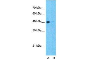 Host:  Rabbit  Target Name:  SPOP  Sample Type:  Hela  Lane A:  Primary Antibody  Lane B:  Primary Antibody + Blocking Peptide  Primary Antibody Concentration:  1ug/ml  Peptide Concentration:  5ug/ml  Lysate Quantity:  25ug/lane/lane  Gel Concentration:  0.