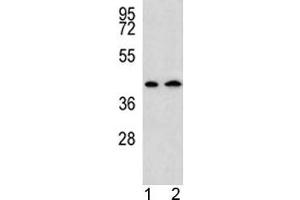 AADAT antibody western blot analysis in human 1) HepG2, and 2) Y79 lysate.