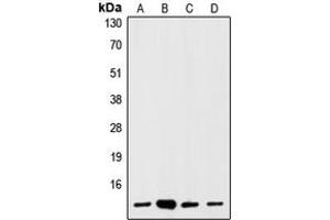 Western blot analysis of S100-A1 expression in HEK293T (A), mouse brain (B), rat brain (C), C6 (D) whole cell lysates. (S100A1 抗体  (N-Term))