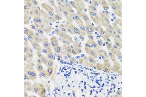 Immunohistochemistry of paraffin-embedded human liver injury using HSD11B2 antibody (ABIN5995471) at dilution of 1/100 (40x lens). (HSD11B2 抗体)