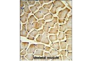 Formalin-fixed and paraffin-embedded human skeletal muscle reacted with PIK4CB Antibody (Center), which was peroxidase-conjugated to the secondary antibody, followed by DAB staining. (PI4KB 抗体  (AA 519-548))