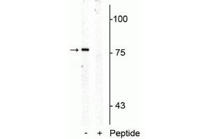 Western blot of rat mid brain membrane lysate showing specific immunolabeling of the ~76 kDa SERT protein phosphorylated at Thr276 in the first lane (-). (SLC6A4 抗体  (pThr276))