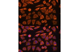 Immunofluorescence analysis of L929 cells using GUCY1 Rabbit pAb (ABIN6127969, ABIN6141533, ABIN6141534 and ABIN6216446) at dilution of 1:100 (40x lens). (GUCY1A1 抗体  (AA 1-120))