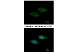Immunofluorescence (IF) image for anti-Syntrophin, beta 2 (Dystrophin-Associated Protein A1, 59kDa, Basic Component 2) (SNTB2) antibody (ABIN2856646)