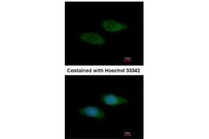 ICC/IF Image Immunofluorescence analysis of methanol-fixed HeLa, using SNTB2, antibody at 1:200 dilution. (SNTB2 抗体)