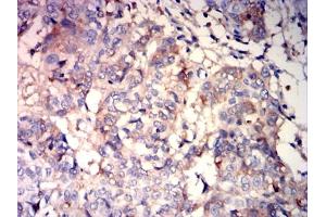 Immunohistochemistry (IHC) image for anti-Albumin (ALB) (AA 410-609) antibody (ABIN7193632)