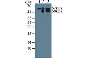 Figure. (Cytokeratin 7 抗体  (AA 91-394))