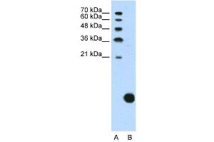 WB Suggested Anti-RPS29  Antibody Titration: 1. (RPS29 抗体  (N-Term))
