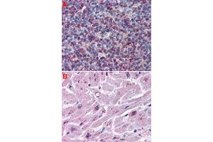 Immunohistochemistry (Formalin/PFA-fixed paraffin-embedded sections) of human spleen (A) and human heart tissue (B) with CYSLTR2 polyclonal antibody . (CasLTR2 抗体  (Extracellular Domain))