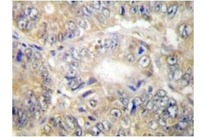 Image no. 1 for anti-Tumor Necrosis Factor (Ligand) Superfamily, Member 13 (TNFSF13) antibody (ABIN272145) (TNFSF13 抗体)